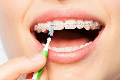 Patient learning Oral Healthcare In Review Proper Cleanings For Braces