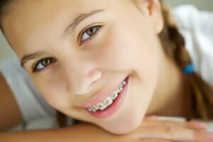 young girl wearing traditional braces