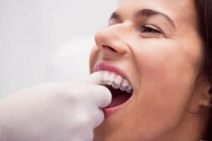 Invisalign in Suwanee