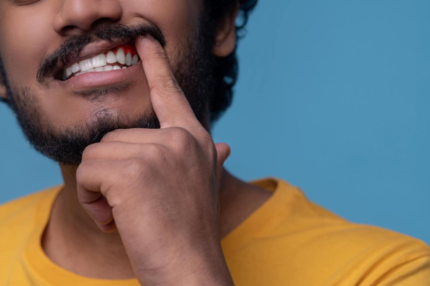 Diabetes and Periodontal Disease